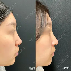 90 days after image