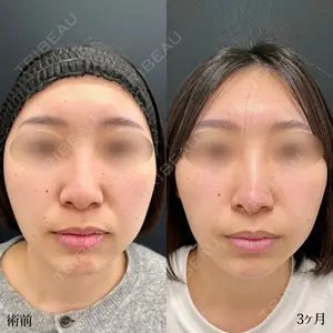 90 days after image