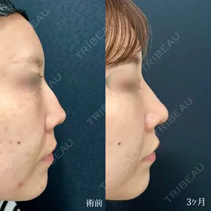 90 days after image