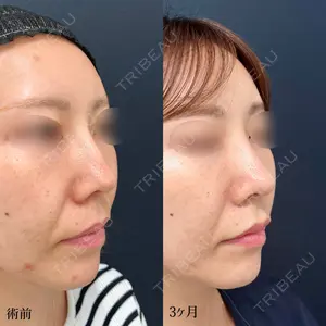 90 days after image