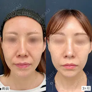 90 days after image