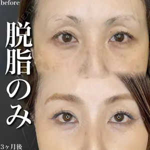 30 days after image