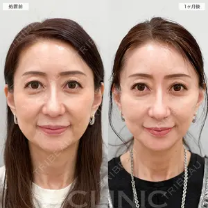 60 days after image