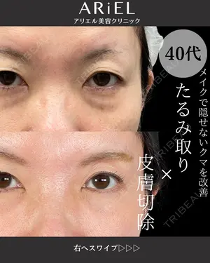 90 days after image