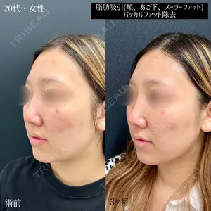 90 days after image