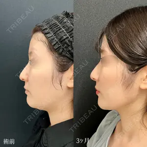 90 days after image