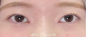 90 days after image