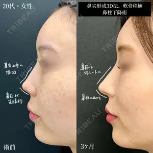 90 days after image