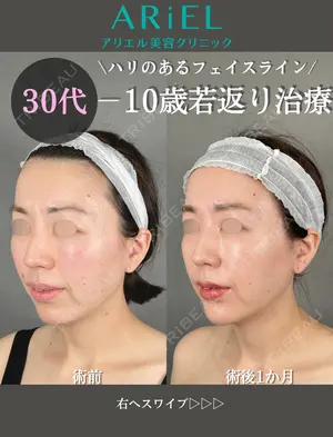 30 days after image
