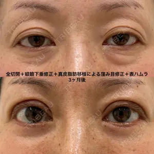 90 days after image