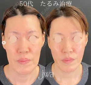 null days after image