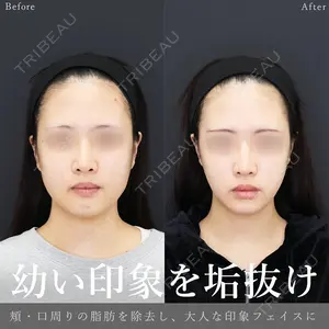 90 days after image