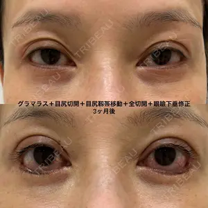 90 days after image