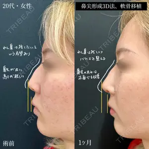 30 days after image