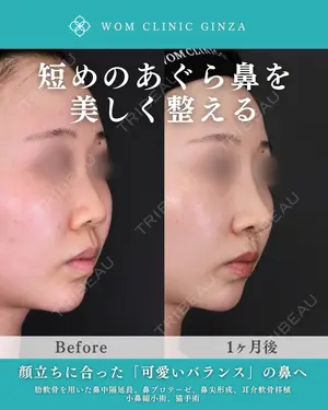 30 days after image