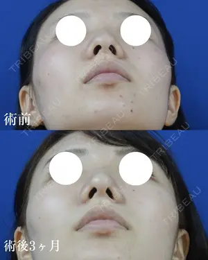 before image