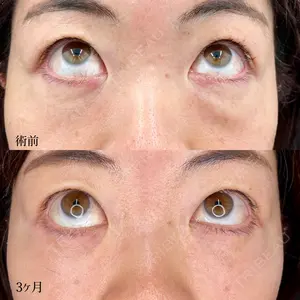 90 days after image