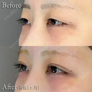 before image