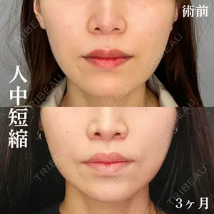 90 days after image