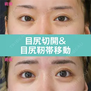 30 days after image