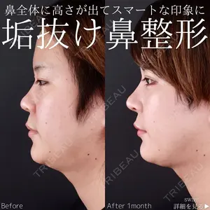 30 days after image