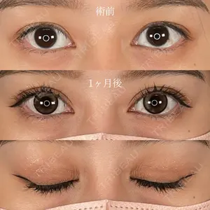 before image