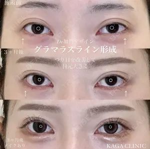 before image