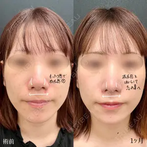 30 days after image