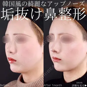 30 days after image