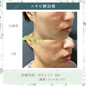 before image
