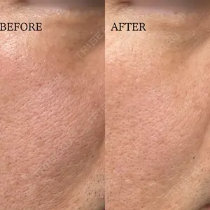 10 days after image