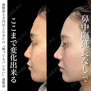 null days after image