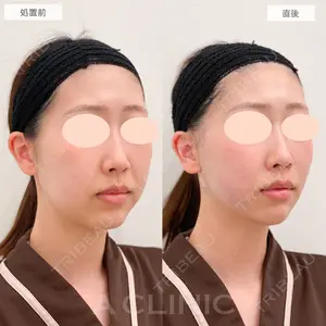 0 days after image