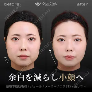 180 days after image