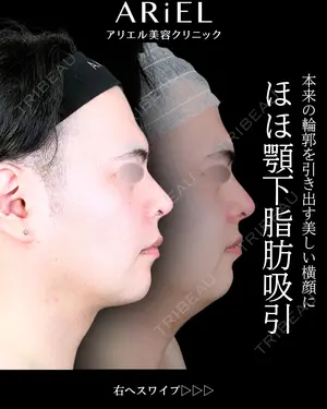 180 days after image