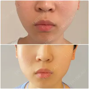 14 days after image