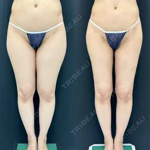30 days after image
