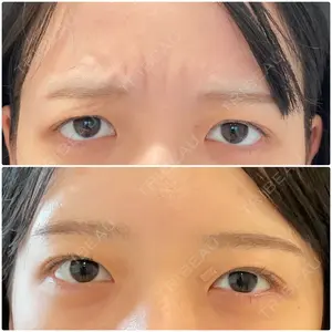 14 days after image