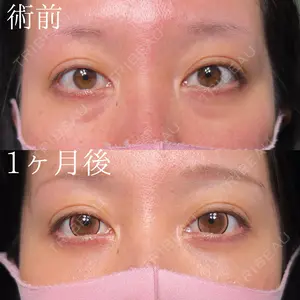 before image