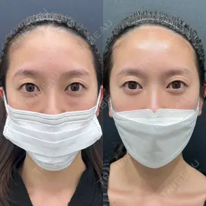 30 days after image