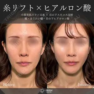 30 days after image
