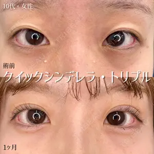 30 days after image