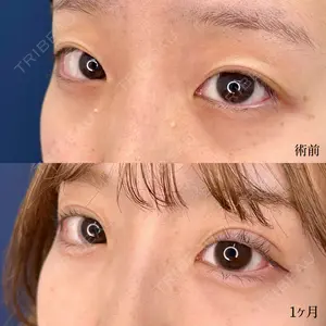 30 days after image