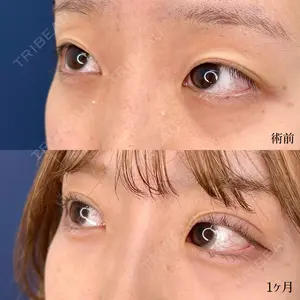 before image