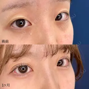 30 days after image