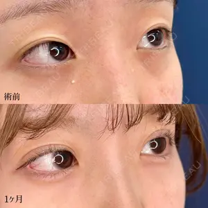 before image