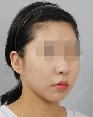 30 days after image