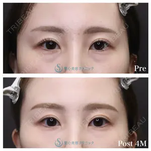 null days after image