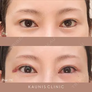 before image