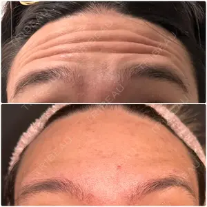 20 days after image